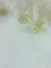 Cortinarius glaucocyanopus