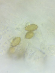 Cortinarius glaucocyanopus