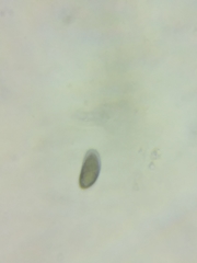 Cortinarius glaucocyanopus