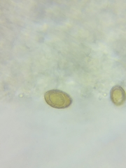 Cortinarius glaucocyanopus