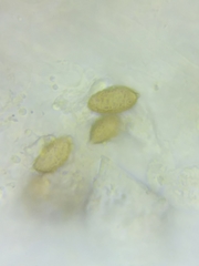 Cortinarius glaucocyanopus