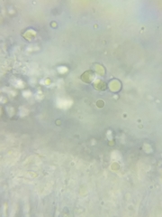 Tricholoma columbetta