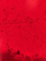 Peniophorella pubera