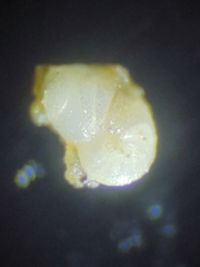 Foraminifera