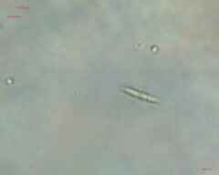 Chlorogonium