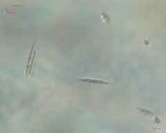 Chlorogonium