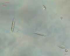 Chlorogonium