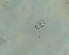 Cocconeis