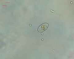 Cocconeis