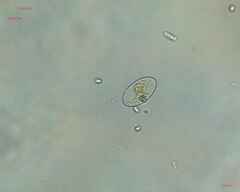 Cocconeis