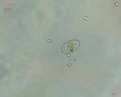Cocconeis