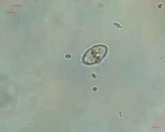 Cocconeis