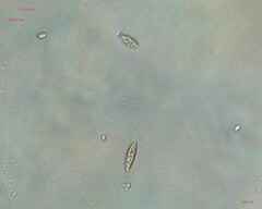 Chlorogonium