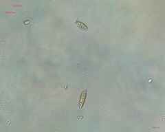 Chlorogonium
