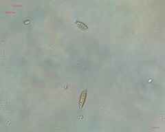 Chlorogonium