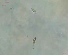 Chlorogonium