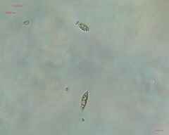 Chlorogonium