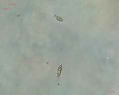 Chlorogonium