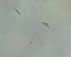 Chlorogonium