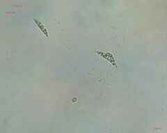 Chlorogonium