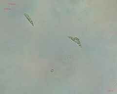 Chlorogonium