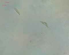 Chlorogonium