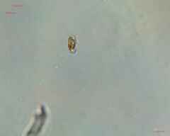 Bacillariophyceae