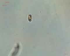 Bacillariophyceae