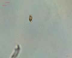 Bacillariophyceae