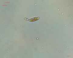 Bacillariophyceae