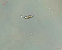 Bacillariophyceae