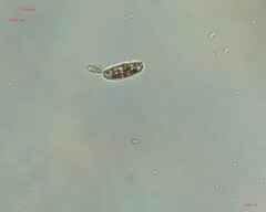 Bacillariophyceae