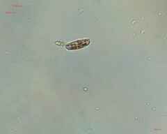 Bacillariophyceae