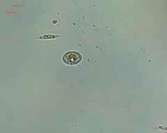 Cocconeis