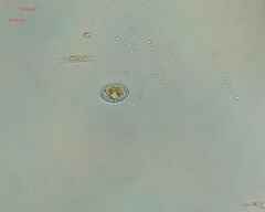 Cocconeis