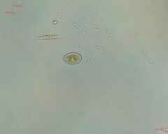 Cocconeis
