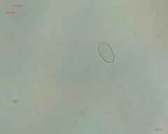 Cocconeis