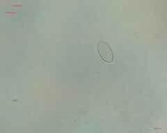 Cocconeis