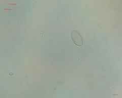 Cocconeis