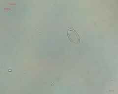 Cocconeis