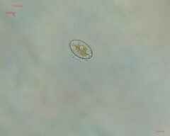 Cocconeis