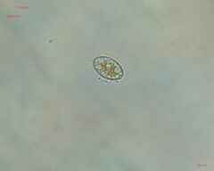 Cocconeis