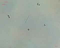 Cyanobacteria