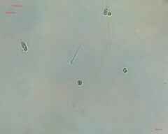 Cyanobacteria
