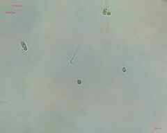 Cyanobacteria