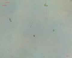 Cyanobacteria