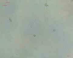 Cyanobacteria