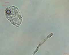 Bacillariophyceae