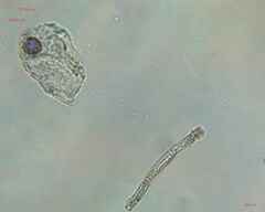 Bacillariophyceae