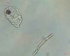 Bacillariophyceae